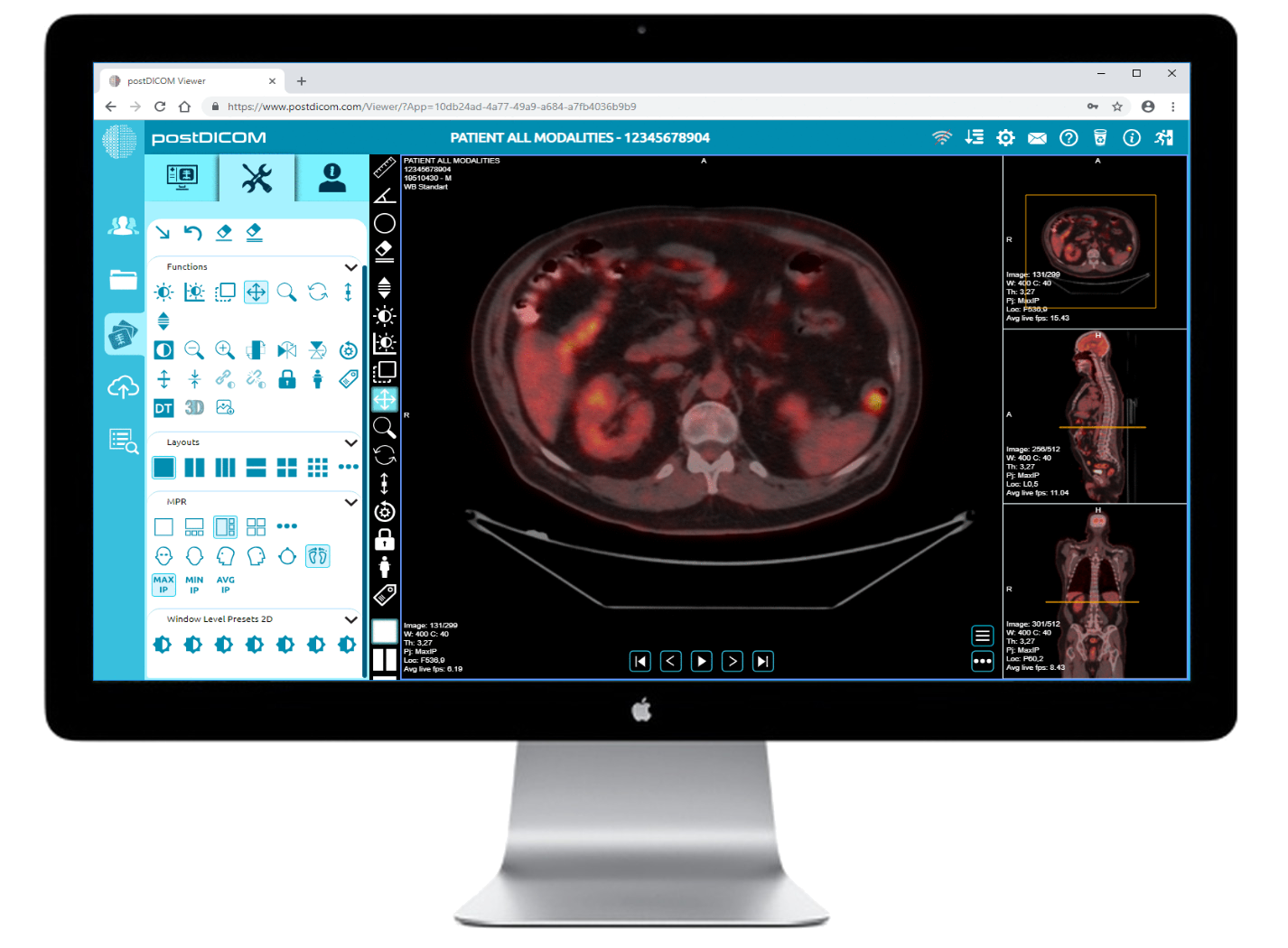 What to Consider When Looking for a DICOM Viewer for Mac - by PostDICOM